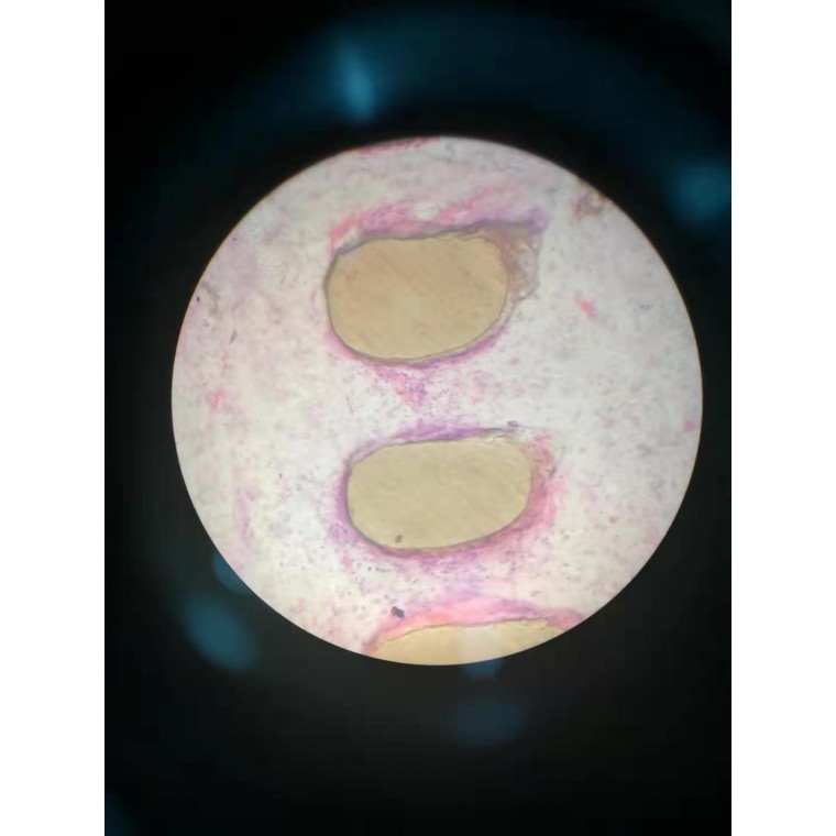 骨磨片显微镜图片图片